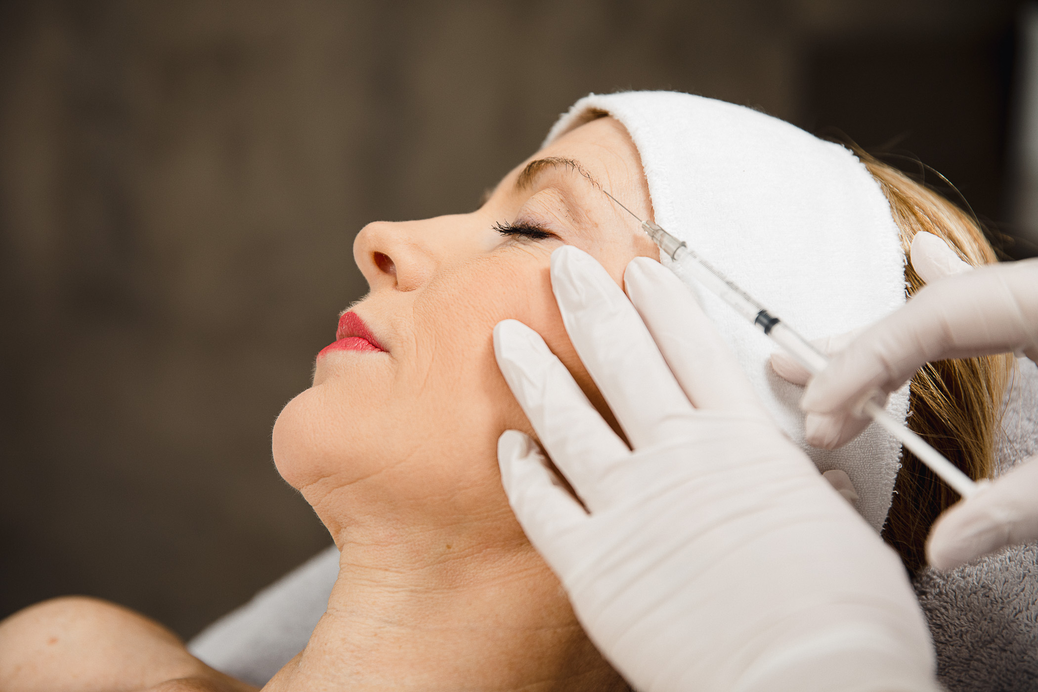 botox en fillers the peeling clinic echt limburg looxs.nl