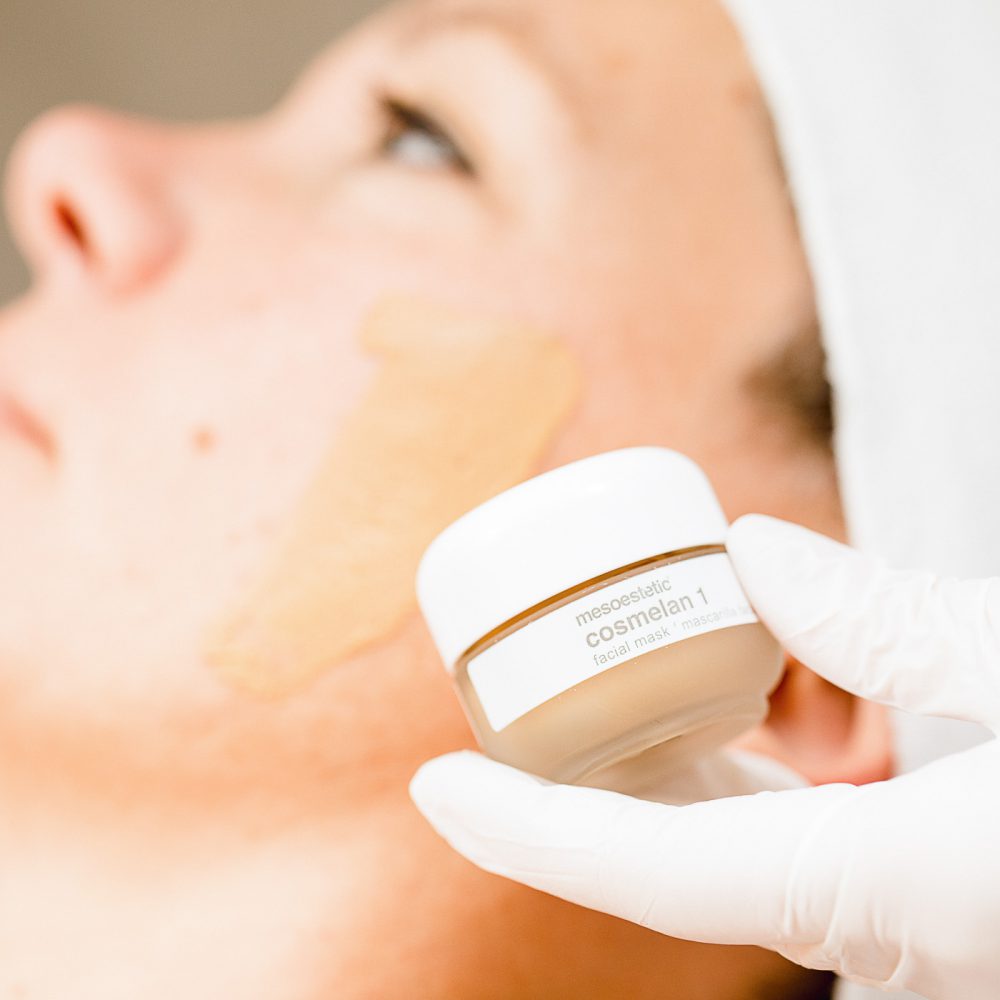 Cosmelan-behandeling mesoestetic The Peeling Clinic