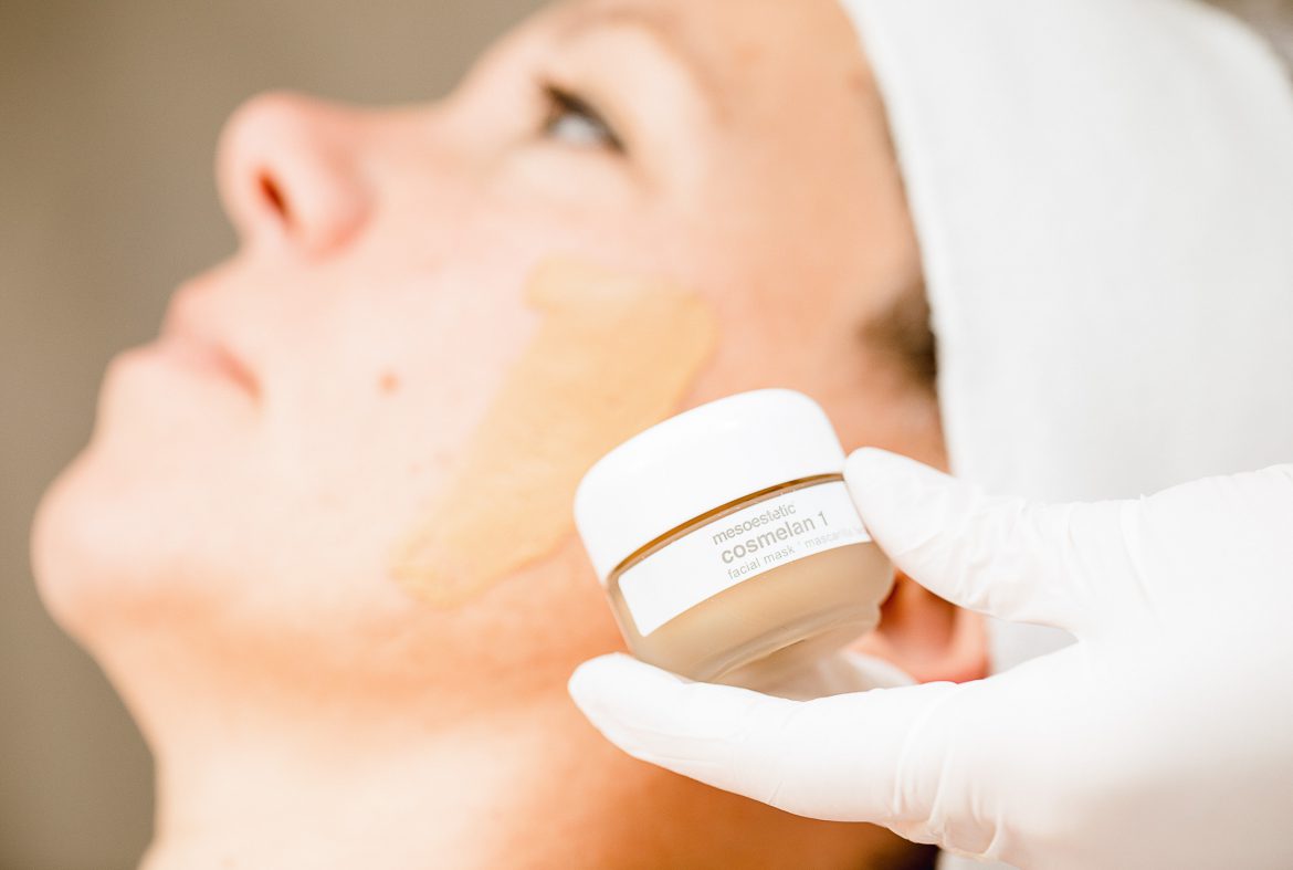 Cosmelan-behandeling mesoestetic The Peeling Clinic