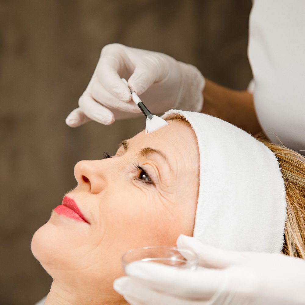 huid nodig na de zomer voorbereiden op peeling looxs thepeelingclinic.nl The Peeling Clinic